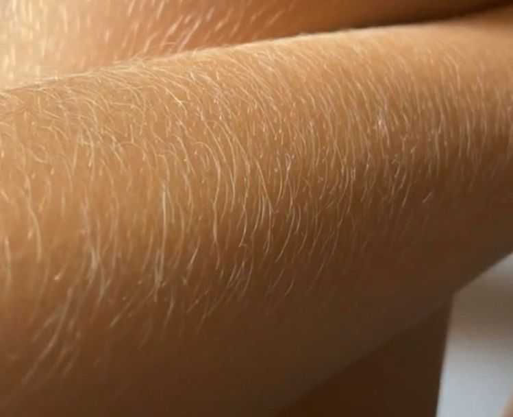 Resultado do Banho de Lua com pelos dourados